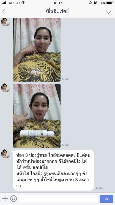 รีวิวเซตคนท้อง